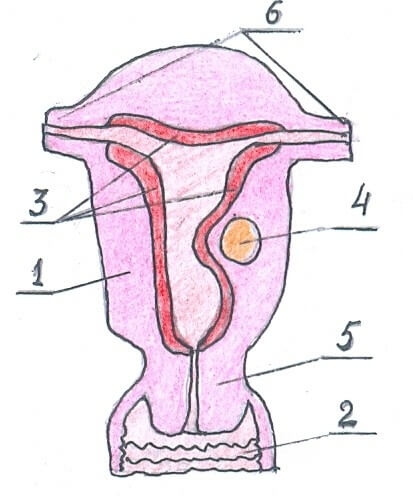 Интерстициально-субмукозная миома тела матки фото