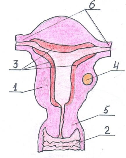 Интертициально-субсерозная миома тела матки фото