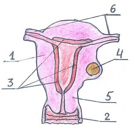 Подбрющинная миома матки тела фото