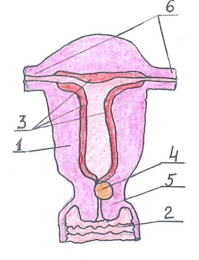 Шеечная миома тела матки фото