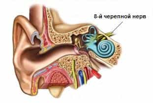 Неврит слухового нерва