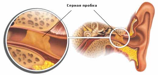 Серная пробка