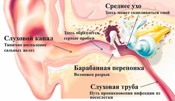 Симптомы отита