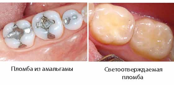 Пломба  металлическая