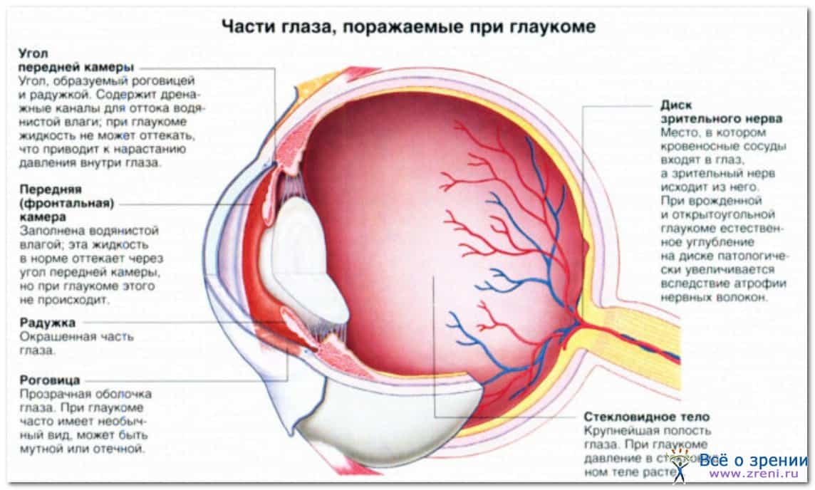 Глаукома