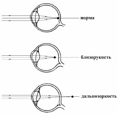 Рефракция