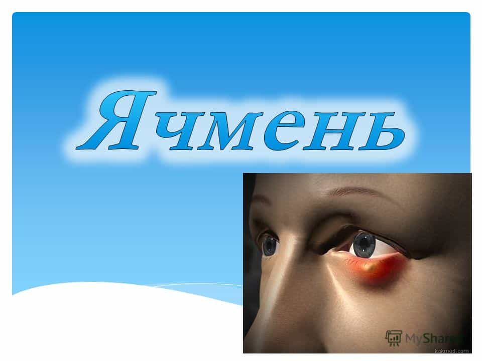 Ячмень