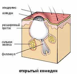 Рисунок открытого камедона