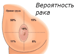 Вероятность рака различных участков молочной железы