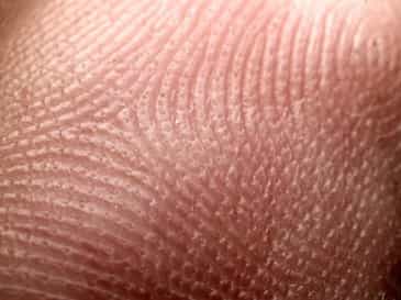 На поверхности кожи видны складки, бороздки и валики, которые переплетаясь между собой, образуют индивидуальный рисунок.