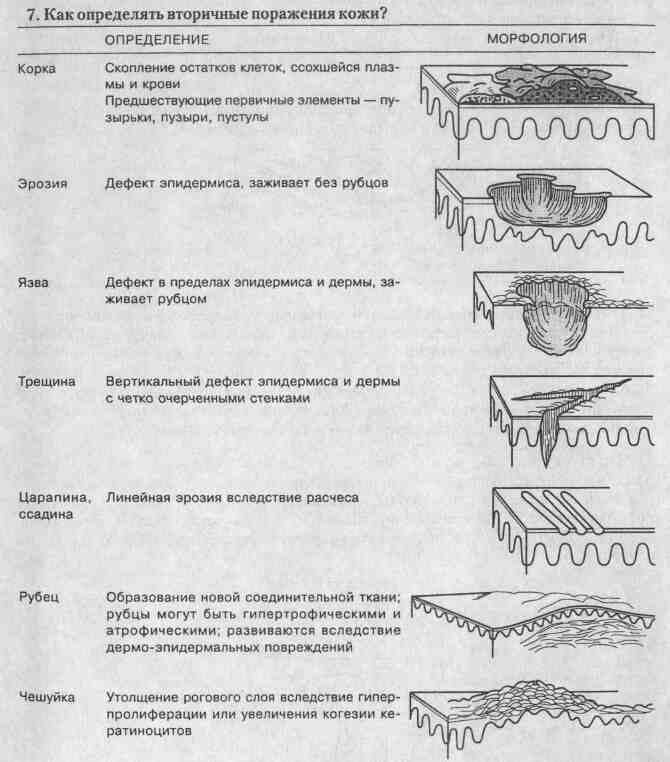 Вторичные морфологические элементы