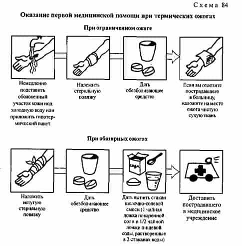 Первая помощь при ожогах