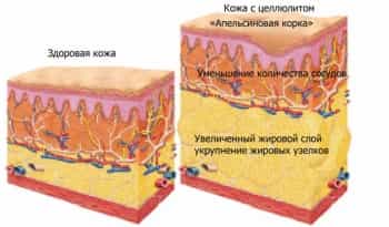 Слой подкожной клетчатки