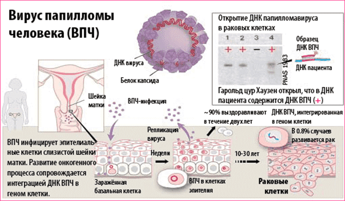 Вирус папилломы человека