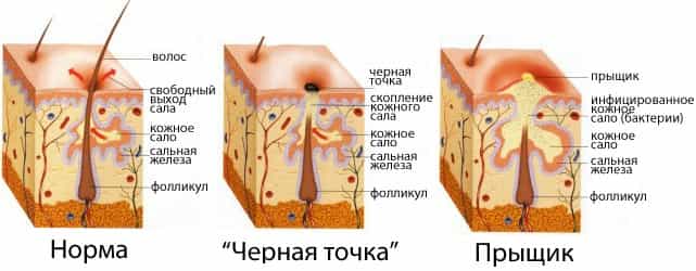 Воспаление кожи