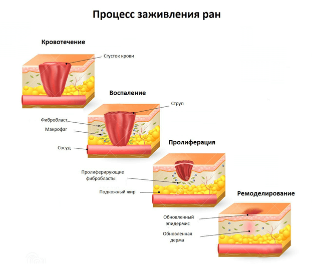 Процесс заживления ран