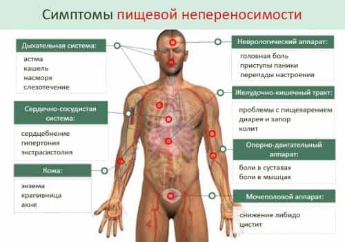 Симптомы пищевой аллергии