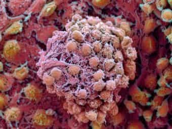 Деление клеток злокачественной опухоли при её росте