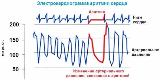 Электрокардиография