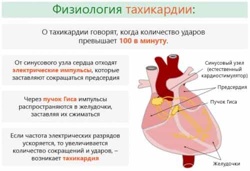 Тахикардия синусовая