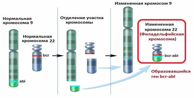 Хронический миелолейкоз