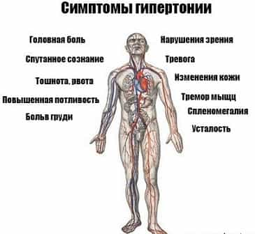 Симптомы гипертонии