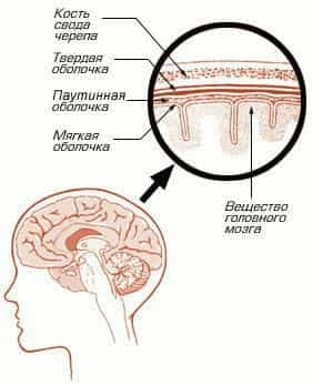 Воспаление мозга