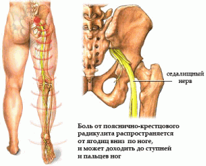 Седалищный нерв