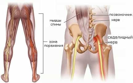 Седалищный нерв