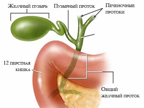 Холецистит хронический