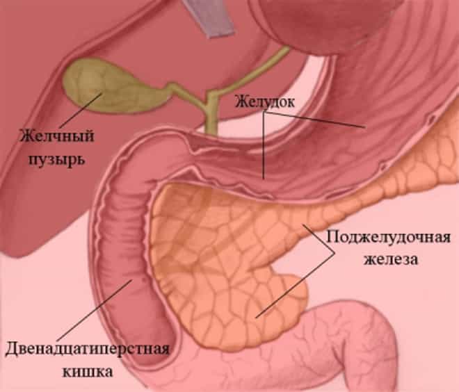 Дуоденит хронический