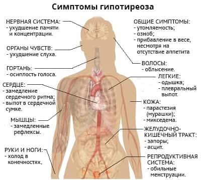 Симптомы гипотиреоза