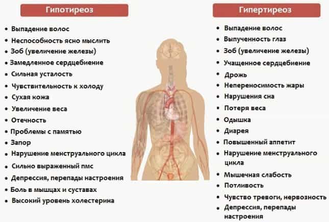 Гипертиреоз