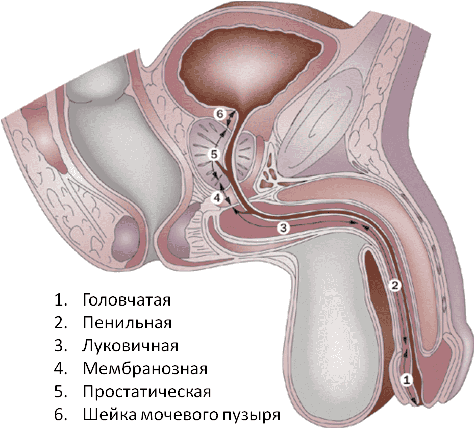 Сужение уретры