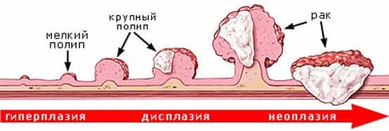 Полип