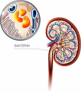 Инфекционные заболевания почек