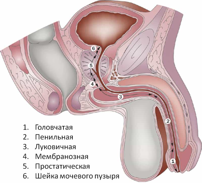 Негонорейный уретрит