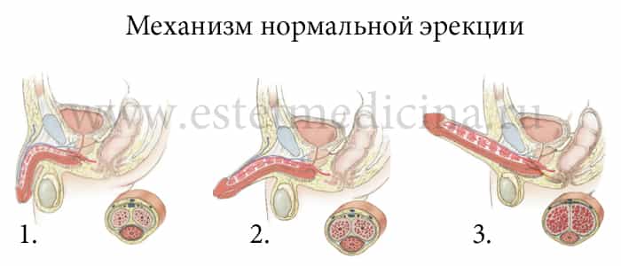 Усиление потенции у диабетиков