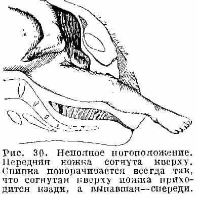 Выпадение мелких частей плода (ножки)