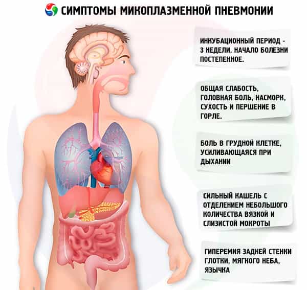 Пневмонии: крупозная, очаговая, хроническая